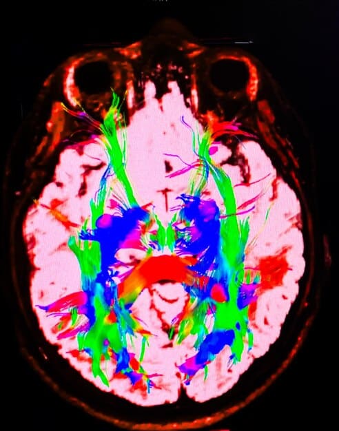 A brain scan showing areas associated with empathy and emotional regulation lighting up.