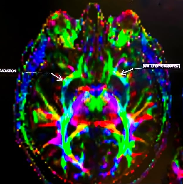 A close-up shot of brain scan images (fMRI) that show areas of the brain lighting up, with a visual overlay highlighting the reward pathways being activated. A subtle, faded text overlay reads 